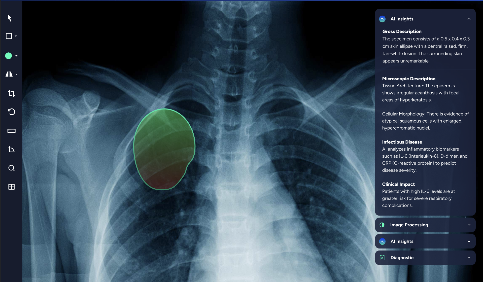 AI insights overlay on X-ray (placeholder)